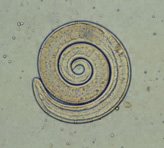 Trichinella spiralis